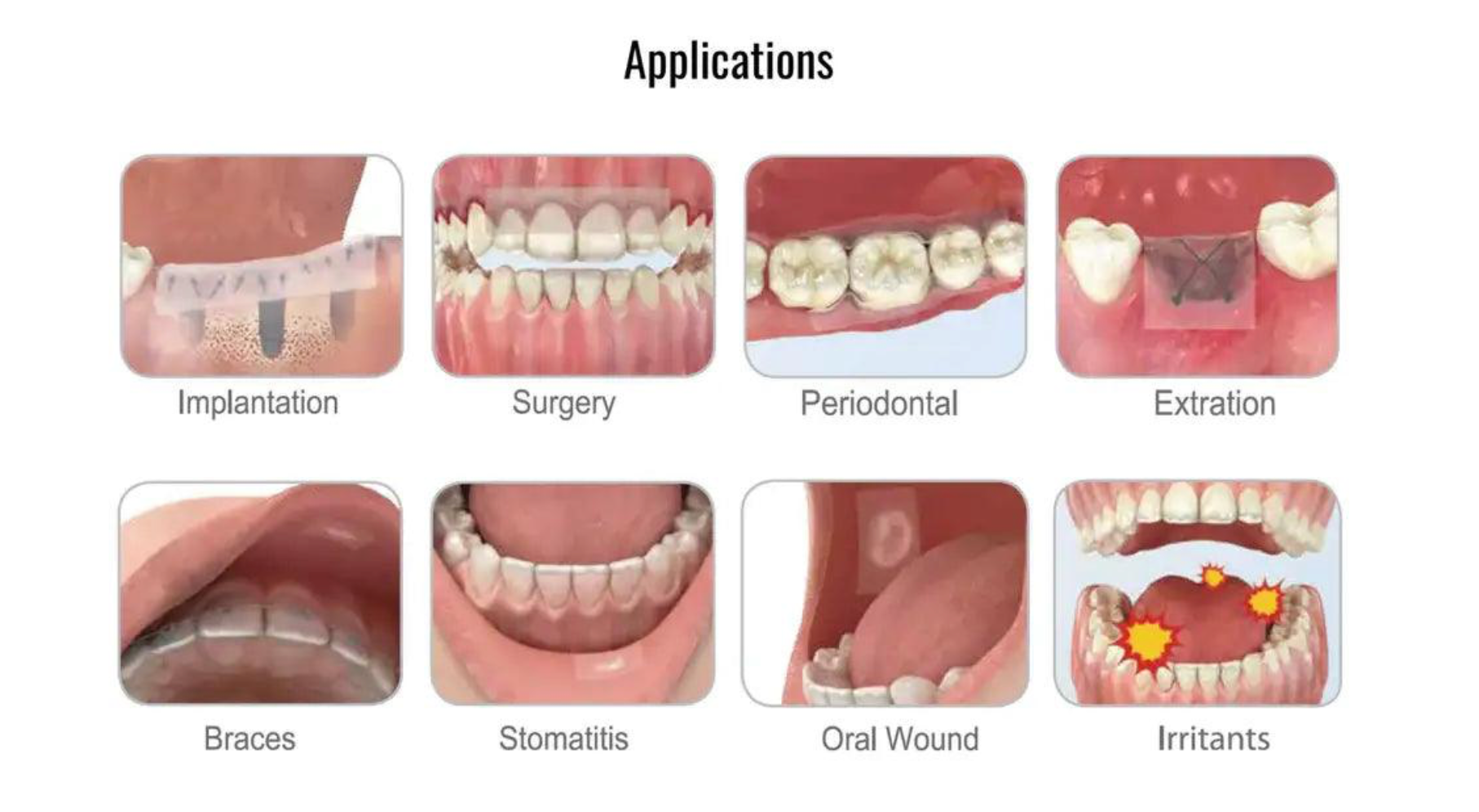 Ora-Aid Intraoral Wound Dressing
