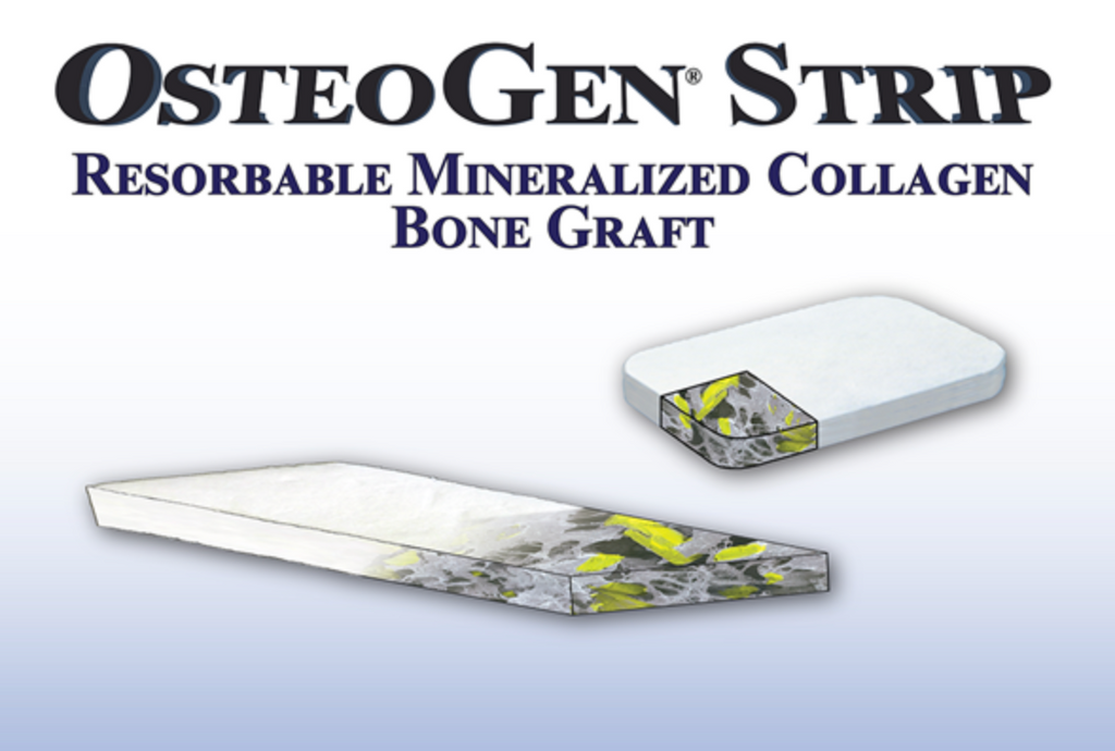 OsteoGen® Strips - Resorbable Mineralized Collagen Bone Graft