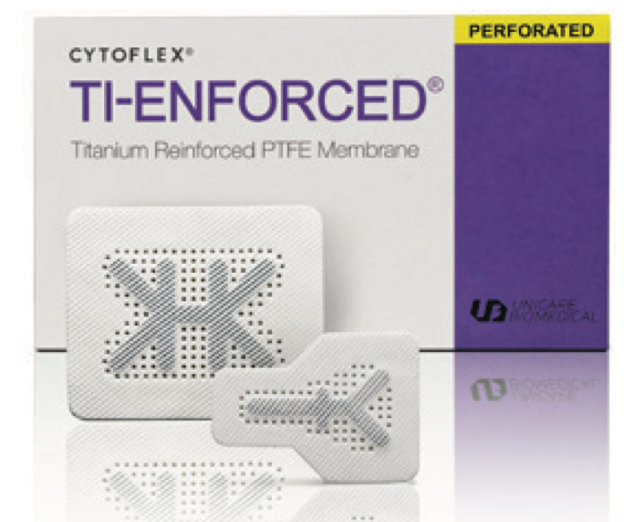 CYTOFLEX®  PERFORATED TI-ENFORCED®